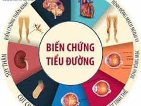 Bị tiểu đường khi nào xuất hiện biến chứng?